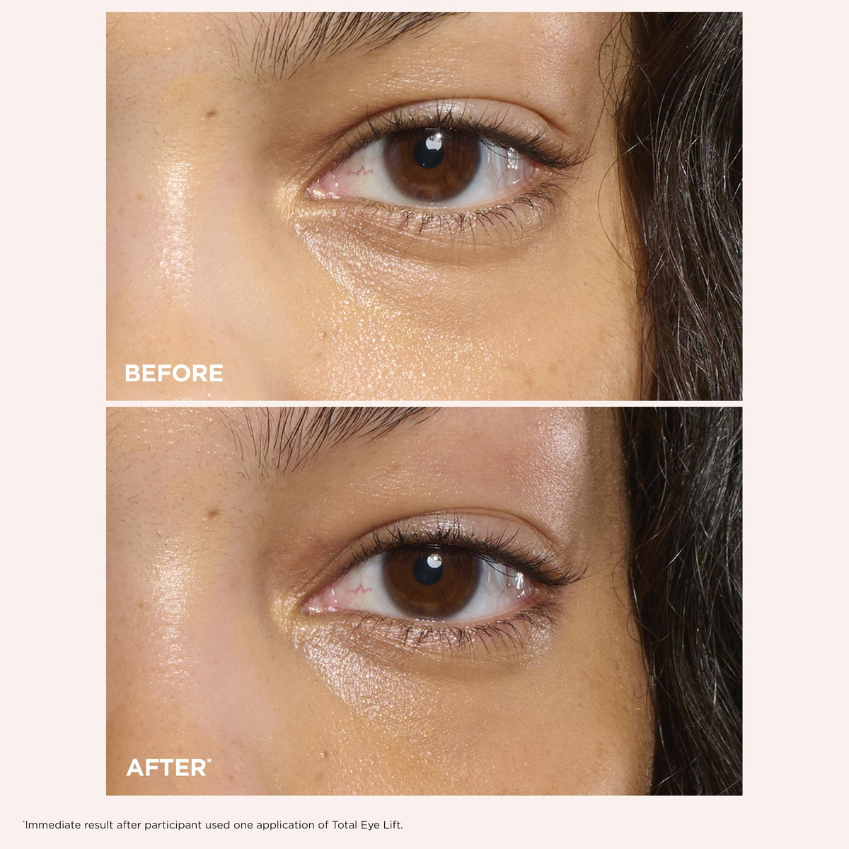 CLARINS before and after comparison showing reduced puffiness and lifted look