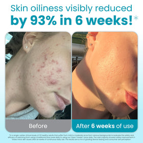 CLEAN SKIN CLUB close-up of raised dot texture showing gentle exfoliation