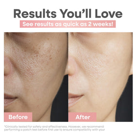 Clear Essence cream texture close-up demonstrating smooth, fast-absorbing finish
