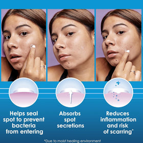 Clearasil patch applied on cheek offering discreet protection