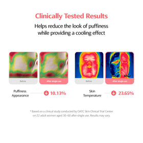 ClearDea pad applied to cheek to contour jawline and reduce puffiness