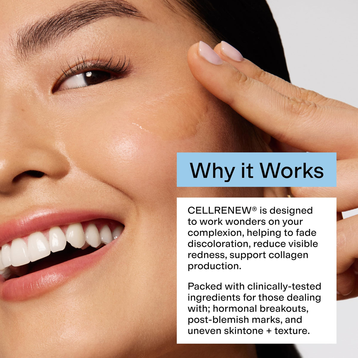 CLEARSTEM application on neck and lips to demonstrate soothing benefit