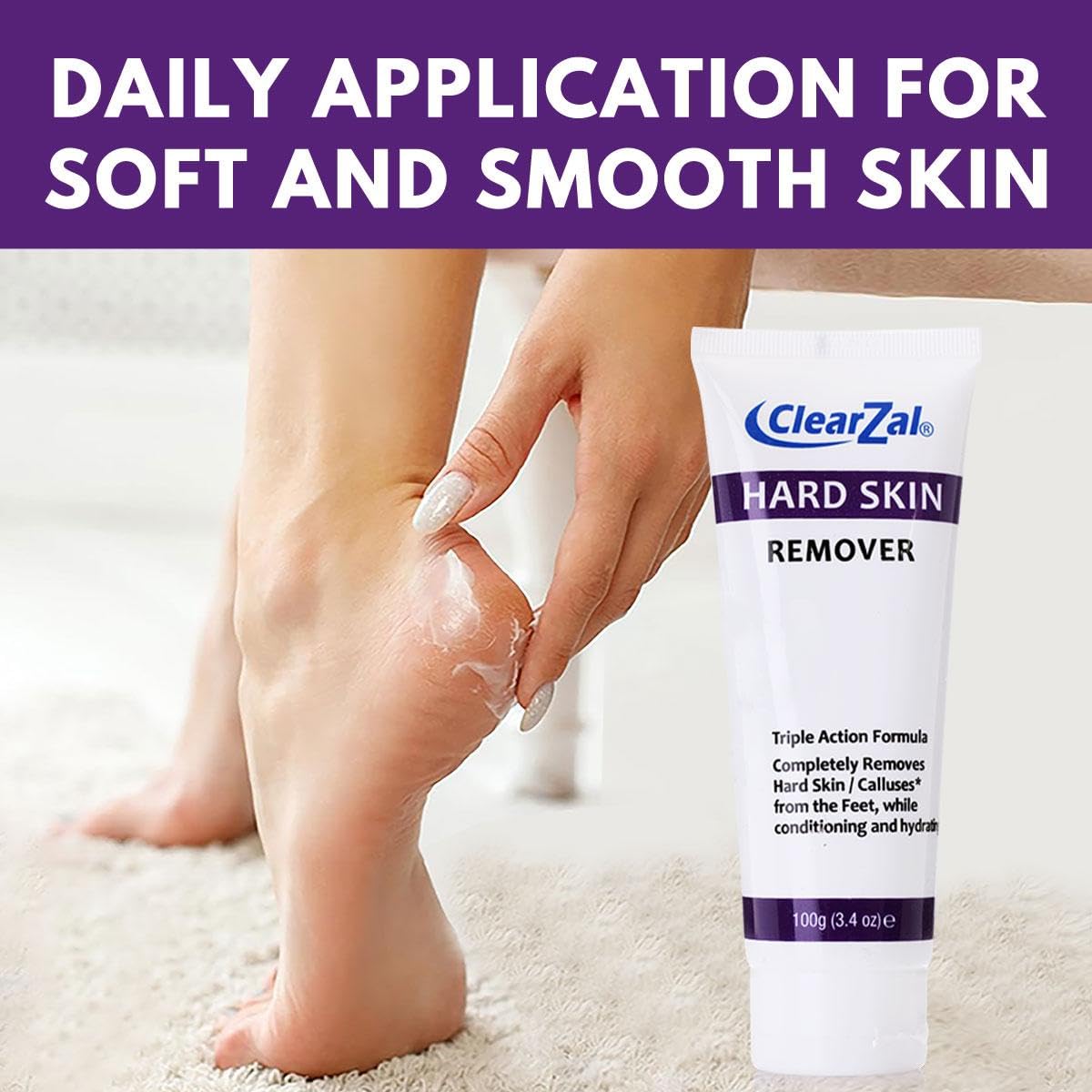 Clearzal being applied to heel demonstrating targeted softening and conditioning