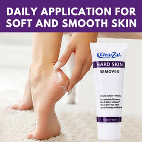 Clearzal being applied to heel demonstrating targeted softening and conditioning
