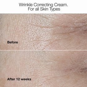 Clinique 2.5 fl oz jar in hand illustrating true size for purchase confidence benefit