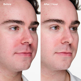 Clinique dispensed gel texture on fingertip showing lightweight fast-absorbing benefit