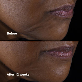 Clinique cream being applied to neck demonstrating lifting and firming