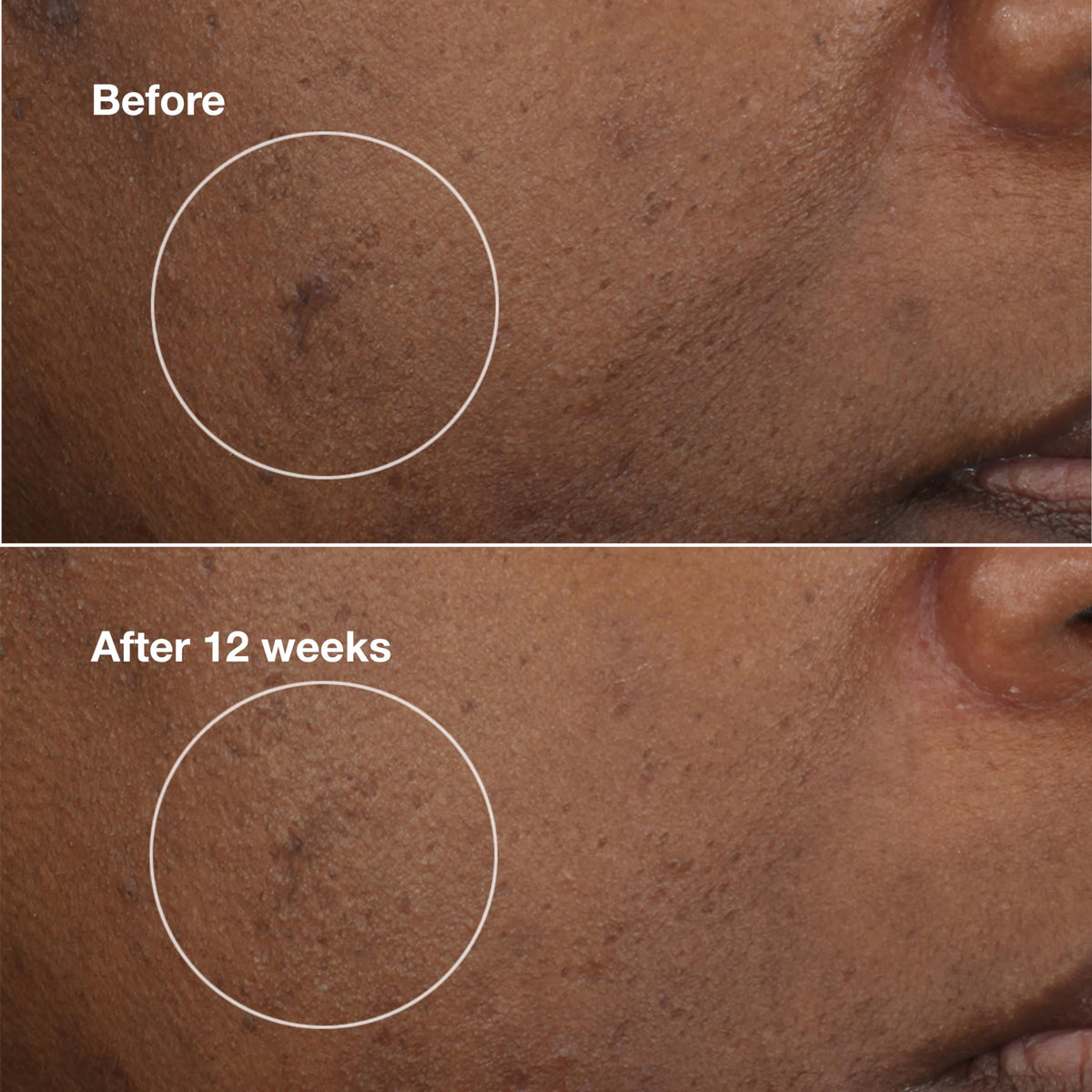 Clinique ingredient label detail highlighting CL302 complex and active benefits