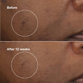 Clinique ingredient label detail highlighting CL302 complex and active benefits