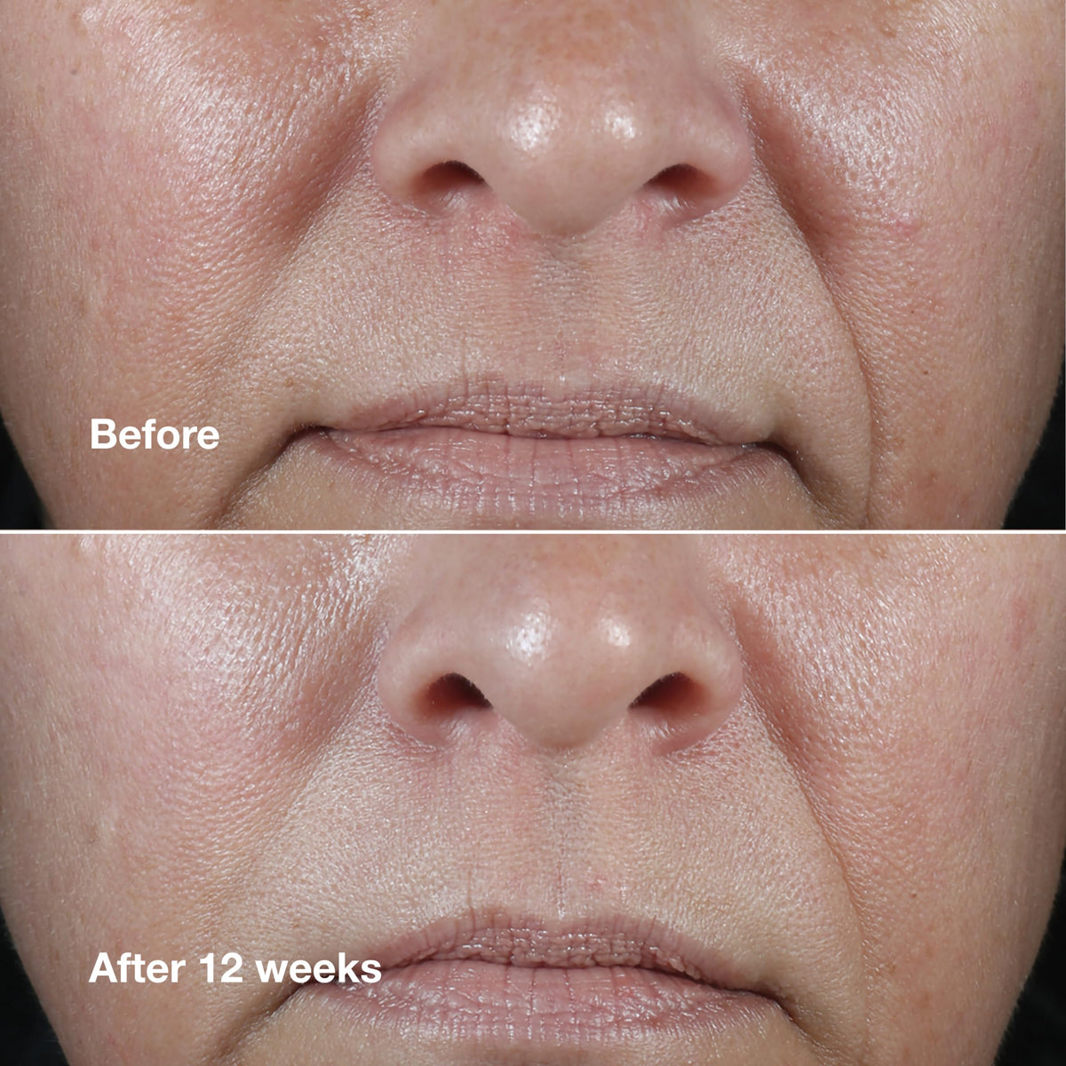 Clinique ingredients closeup with soybean extract, brand supports skin fortify