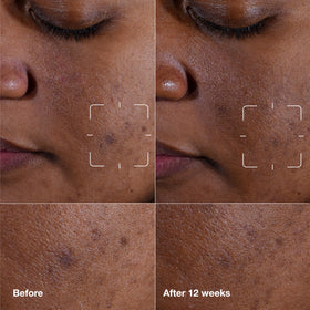 Clinique serum pump and cap detail highlighting easy dispensing and hygiene benefit