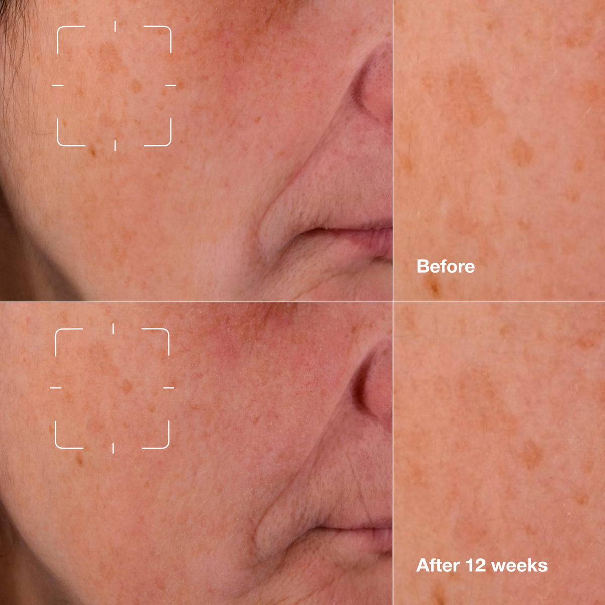 Clinique serum texture on skin, lightweight absorption for quick, non-greasy feel