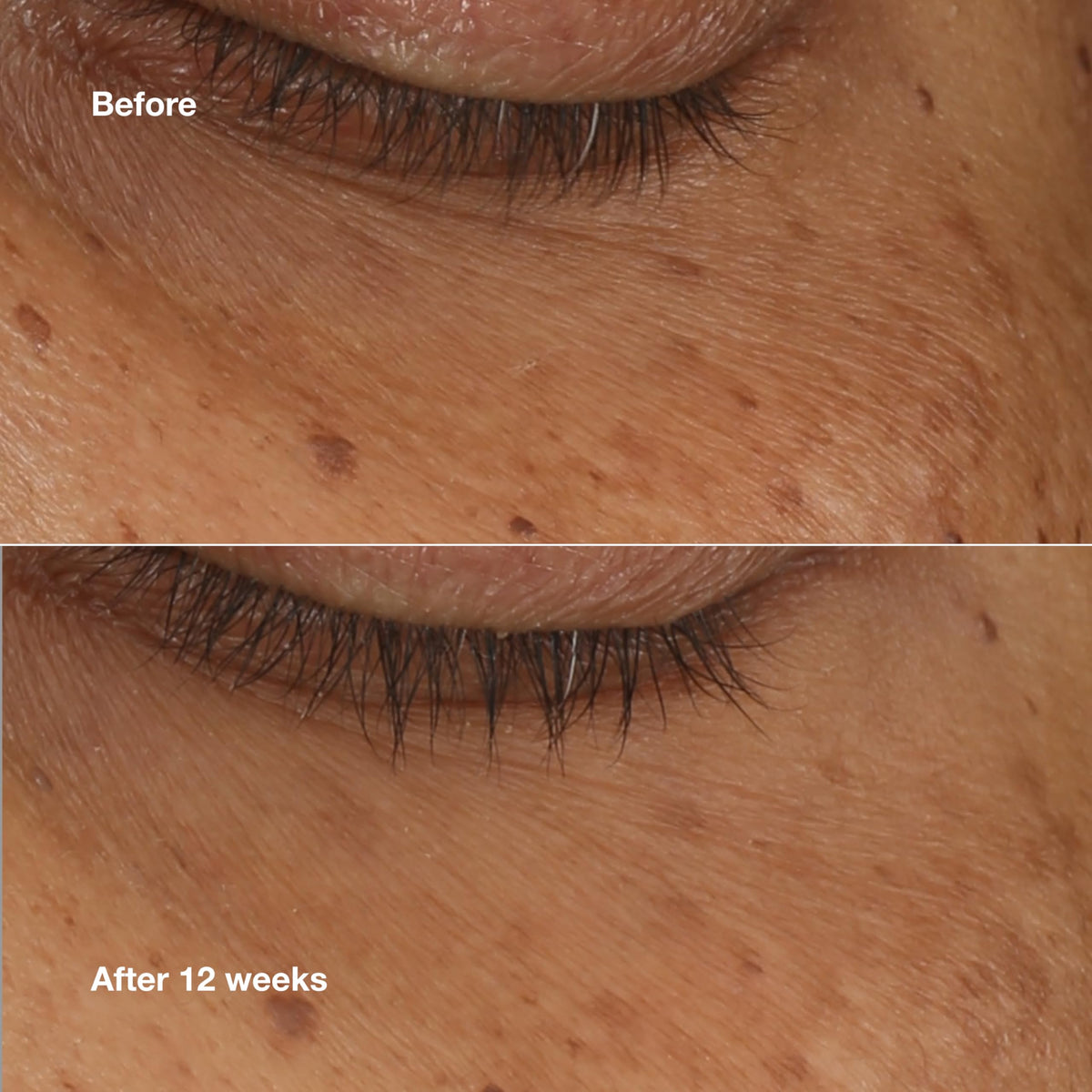 Clinique tube and cap detail showing compact design and travel-friendly benefit