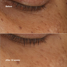 Clinique tube and cap detail showing compact design and travel-friendly benefit