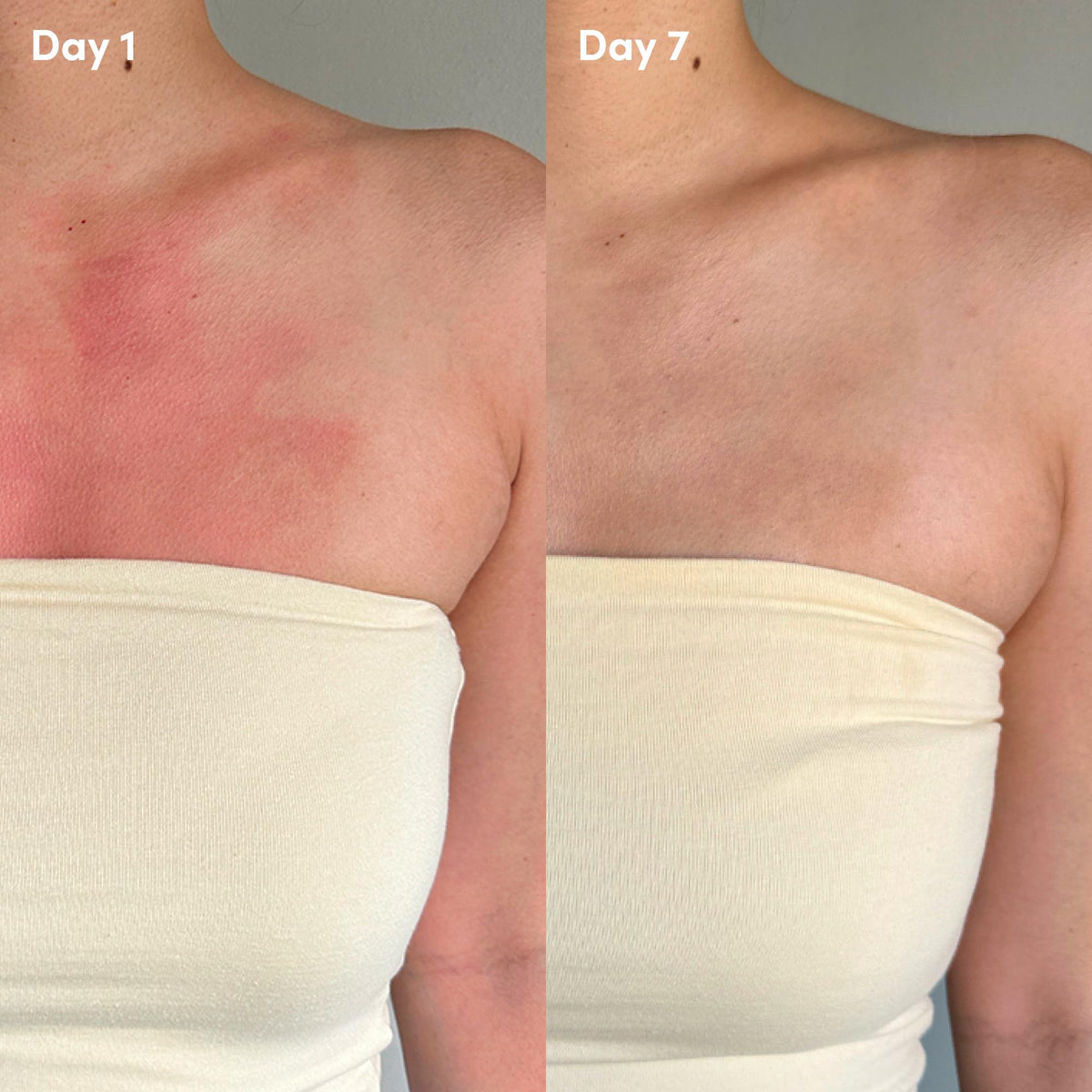 Coco & Eve gel-lotion on sun-kissed skin showing soothing effect and refreshed look