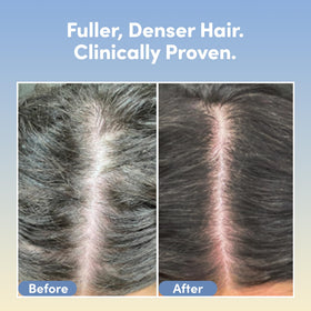 Coco & Eve applicator close-up demonstrating precise scalp targeting and easy use