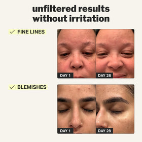 Cocokind pump dispensing gel highlighting easy application and controlled dosing