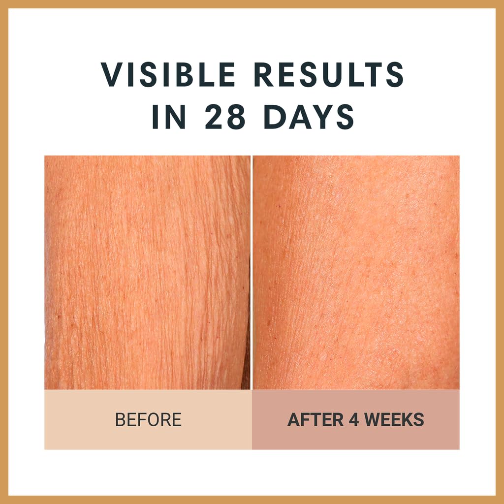 Consult Beaute being applied on arm highlighting improved tone and hydration