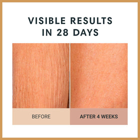Consult Beaute being applied on arm highlighting improved tone and hydration