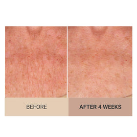 Consult Beaute cream being dispensed to illustrate non-greasy absorption benefit