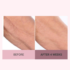 Consult Beaute product applied to décolleté showing smoothing and softening benefit