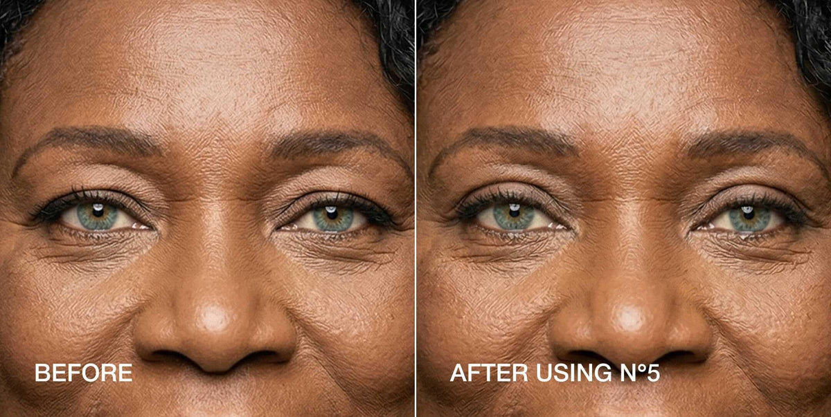 Contours Rx application demo on eyelid showing instant lift