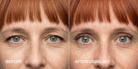 Contours Rx step-by-step application showing correct eyelid placement and reliable lift