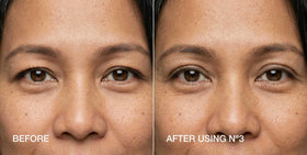 Contours Rx step-by-step application scene showing precise placement with tweezers benefit