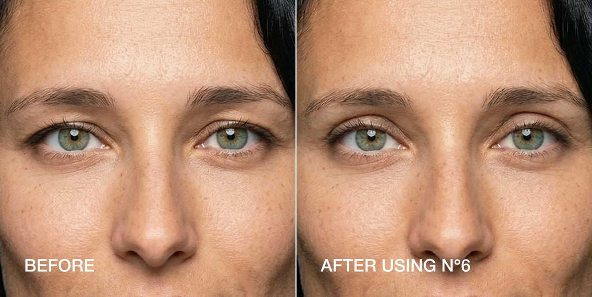 Contours Rx before and after eye comparison showing subtle non-surgical lift benefit