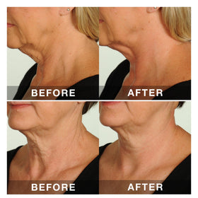 Contours Rx adhesive edge detail highlighting secure, comfortable hold