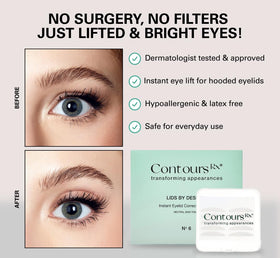 Contours Rx kit contents flatlay including strips, tweezers, and instructions