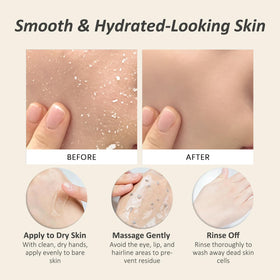 CORACODE application on hand demonstration showing gentle massage removal benefit
