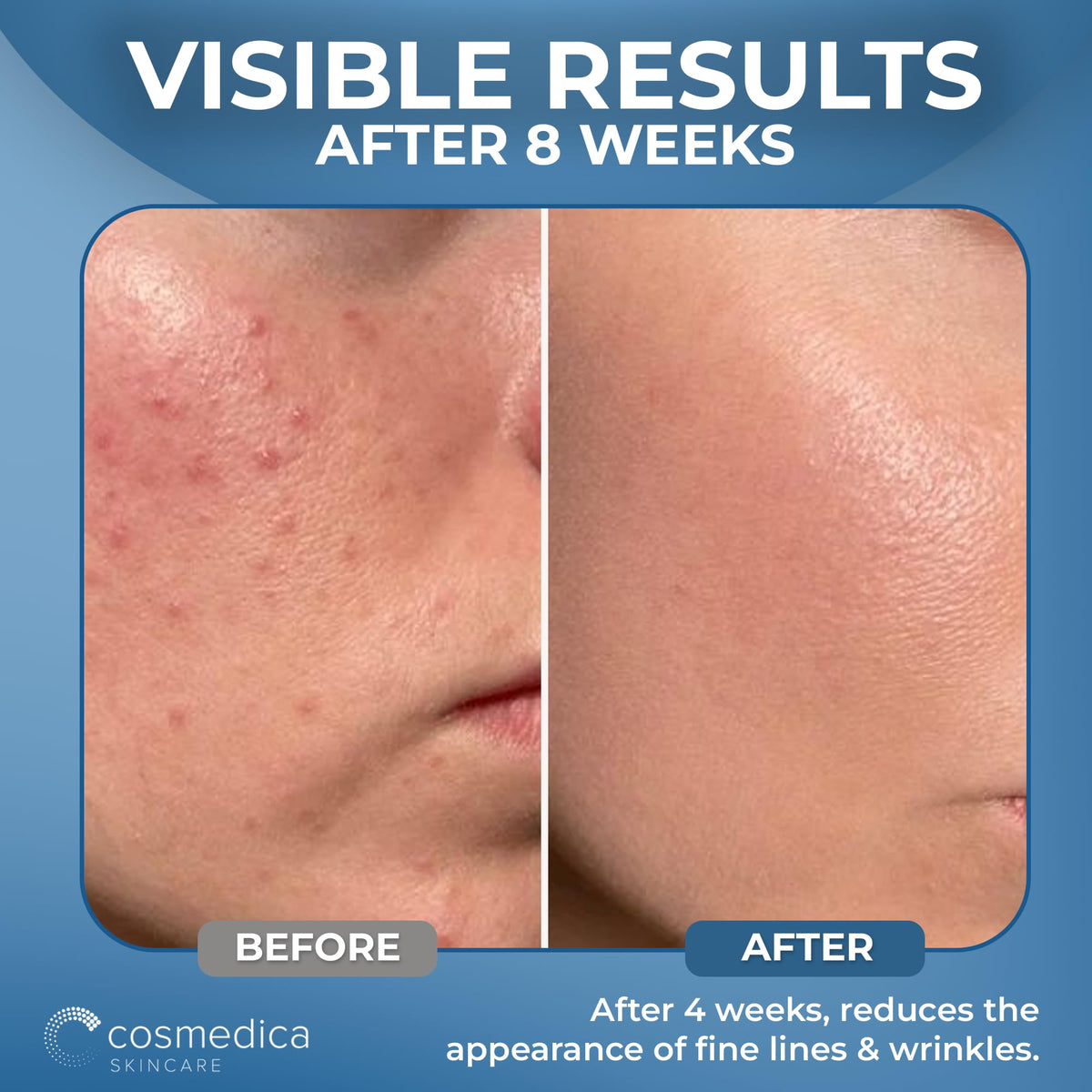 Cosmedica serum being applied to cheek demonstrating quick absorption