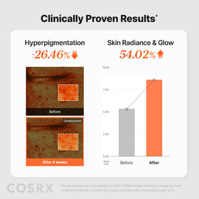 COSRX after application showing brighter under-eye appearance
