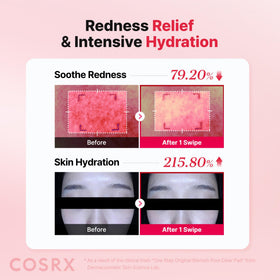 COSRX hand using pad on cheek demonstrating quick blemish care