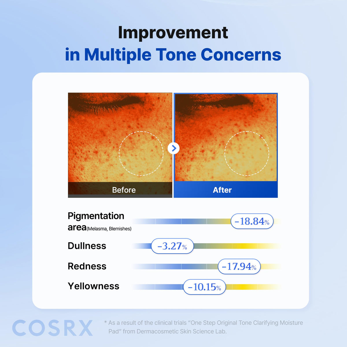 COSRX pad fitting around nose to show curved-area adhesion