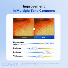 COSRX pad fitting around nose to show curved-area adhesion
