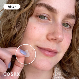 COSRX three sizes displayed and labeled for precise spot coverage benefit