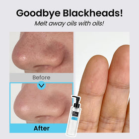 coxir removing mascara and foundation illustrating effective makeup removal