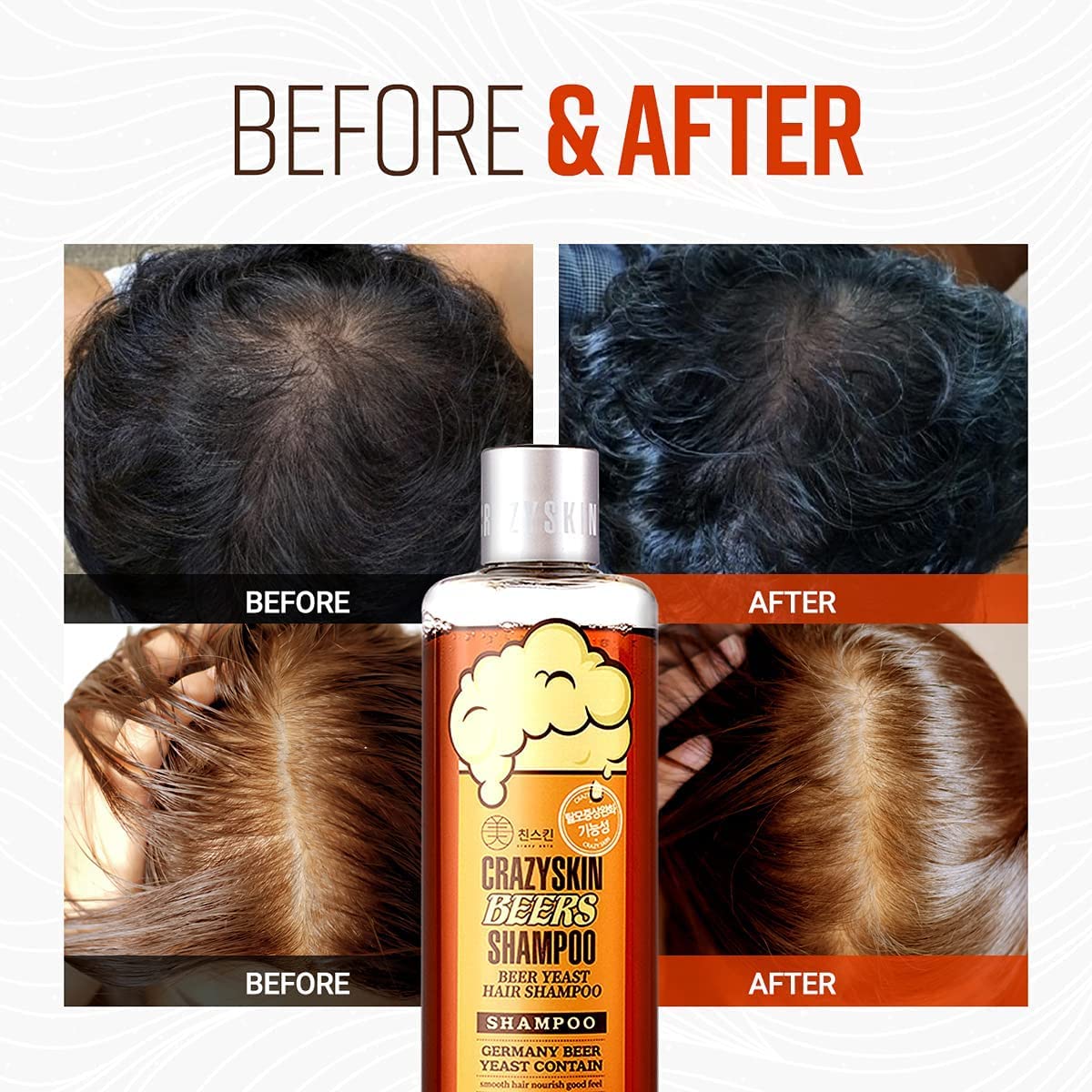 CRAZY SKIN beer yeast close-up highlighting biotin concentration benefits