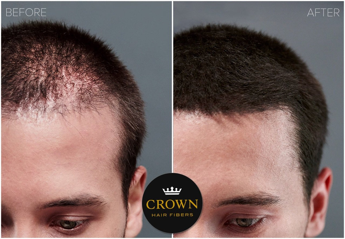 CROWN TWENTY1 sprinkle application on scalp demonstrating quick coverage and instant thicker appearance