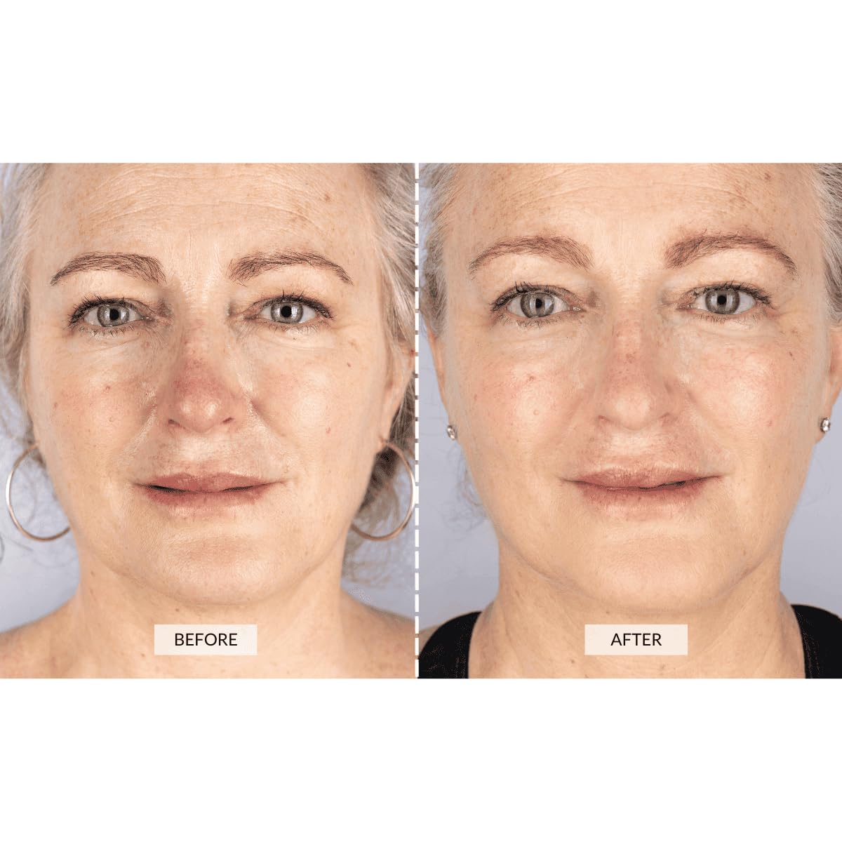 CurrentBody side profile demonstrating silicone fit and comfortable contouring benefit