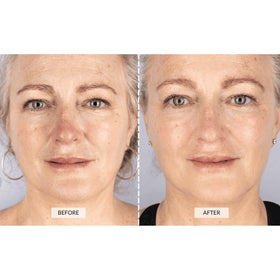 CurrentBody side profile demonstrating silicone fit and comfortable contouring benefit