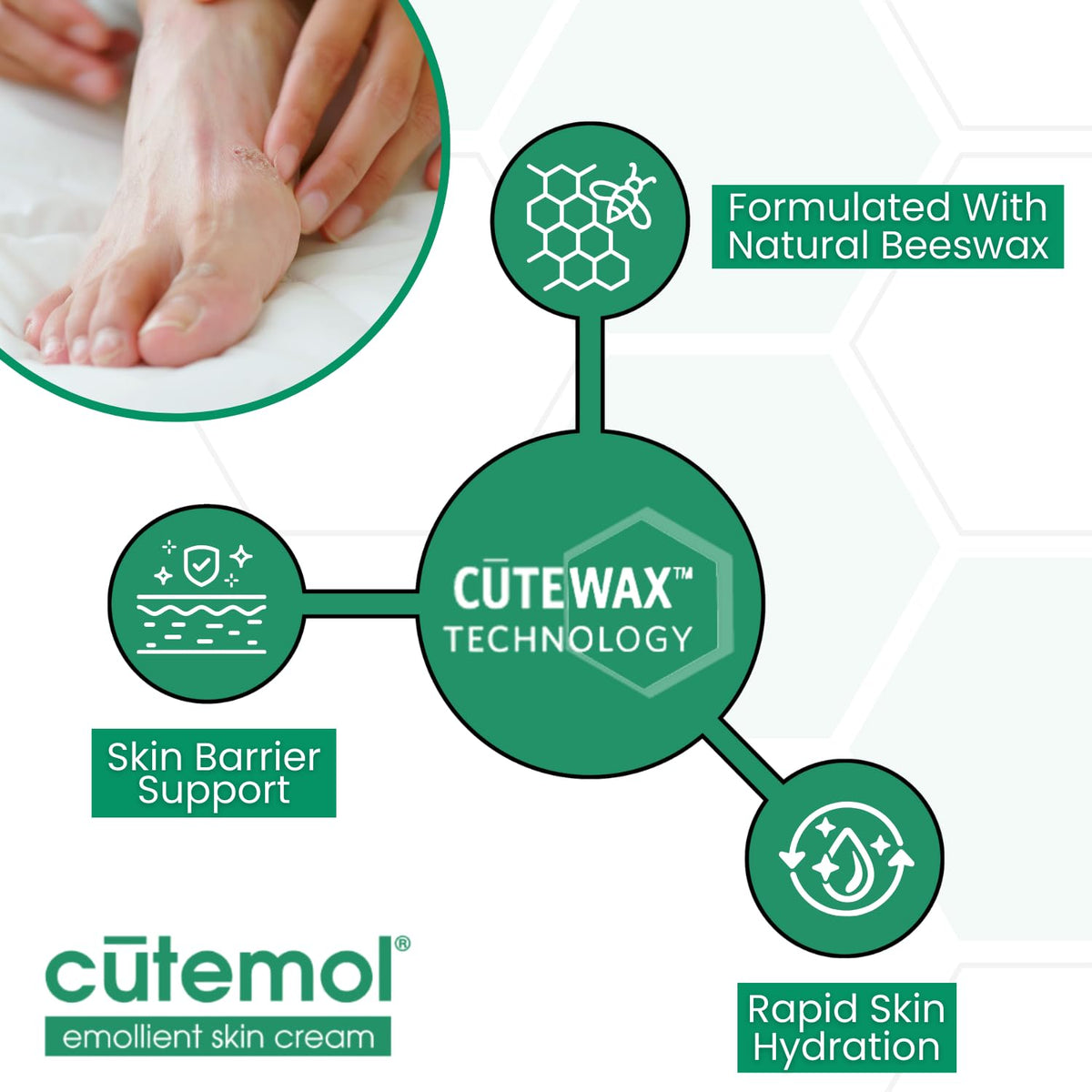 Cutemol applied to a cracked hand demonstrating immediate protective hydration benefit