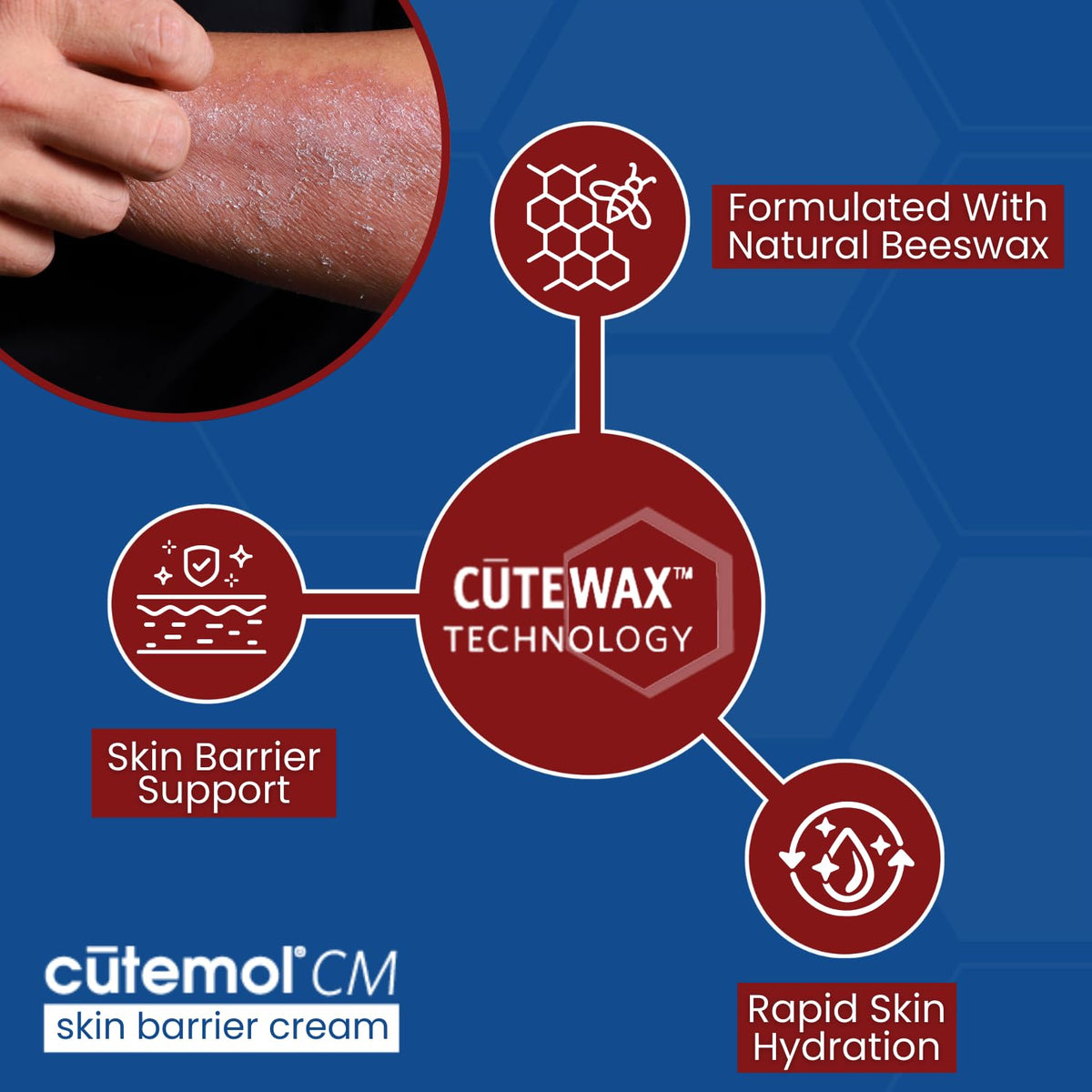 Cutemol being used on heels showing targeted moisture for cracked skin