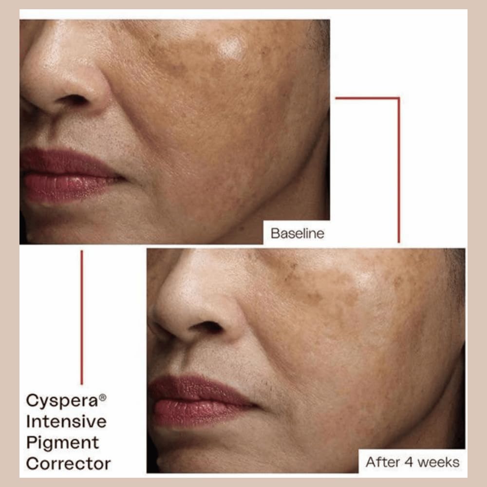 cyspera on bathroom counter in routine setting suggesting daily use