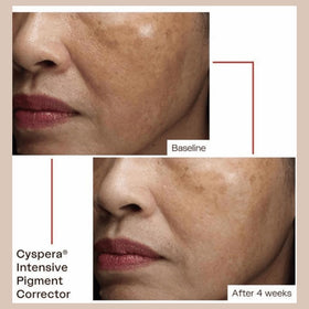cyspera on bathroom counter in routine setting suggesting daily use