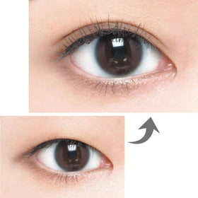 D-UP before and after eye comparison showing defined crease