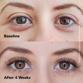 Dabalash beard usage on male face showing improved facial hair density