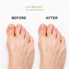 daily remedy foot soak in basin during home pedicure, relaxing effect